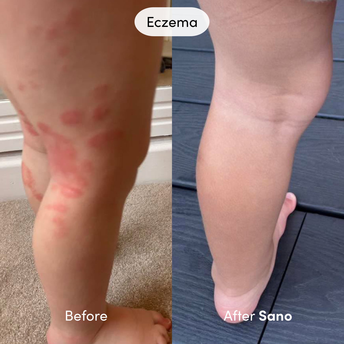 Sano - Natural Skin Repair Cream