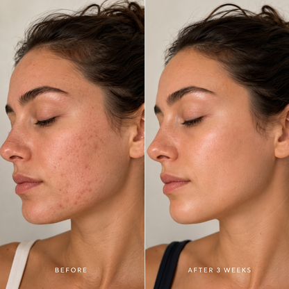Lenis - Gentle Balance Cream